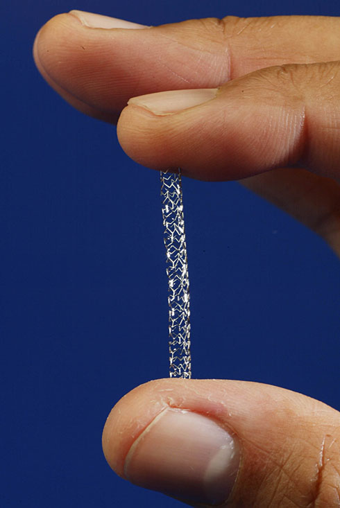 الحجم الطبيعي للأنبوب الشبكي stent