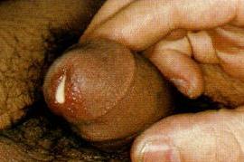 gono gono