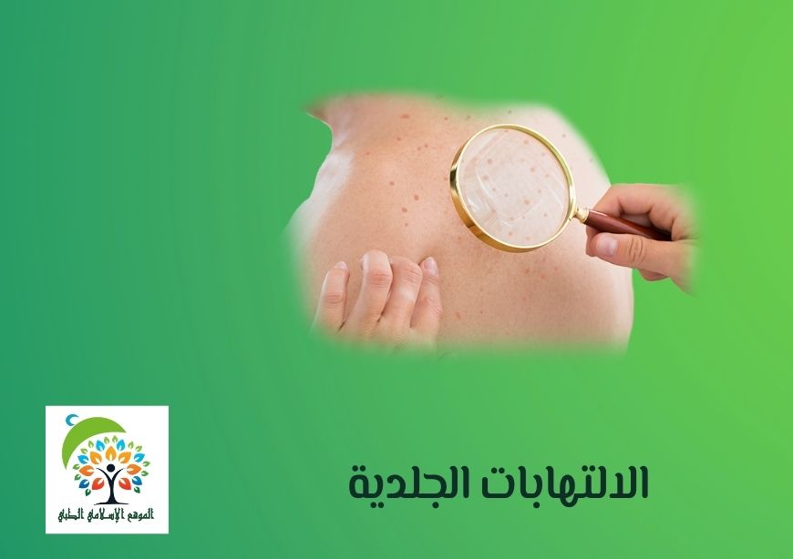 الالتهابات الجلدية